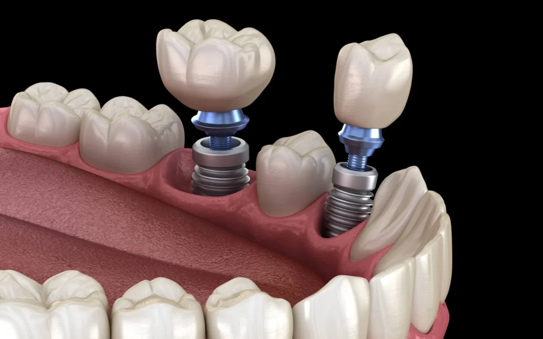 How to Prepare for a Relaxed, Stress-Free Dental Visit